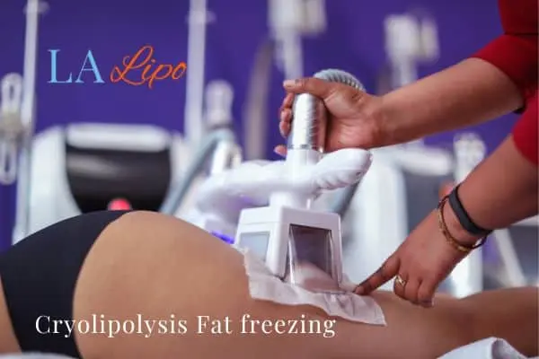 women getting fat freezing Pinner