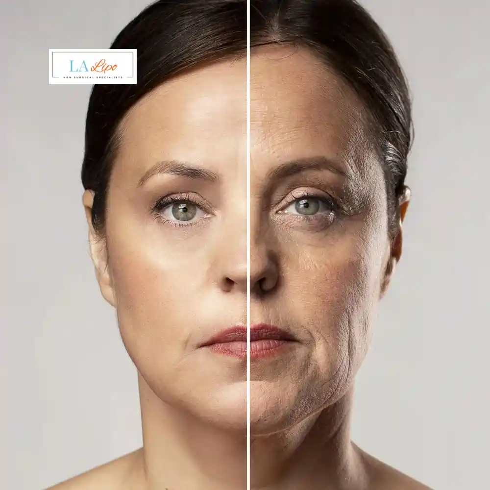 How Can You Tell If Non-Surgical Skin Tightening Is Right for You Pinner?