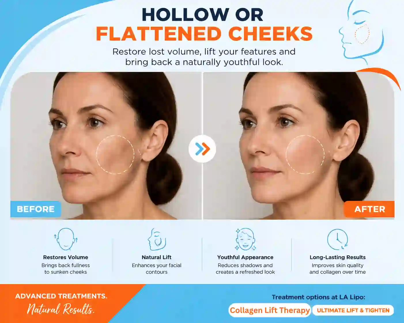 Sign #4: Hollow or Flattened Cheeks Pinner