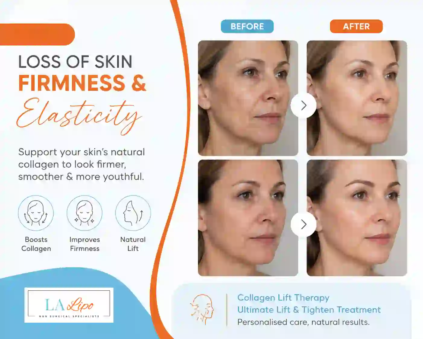 Sign #7: Loss of Skin Firmness and Elasticity Pinner